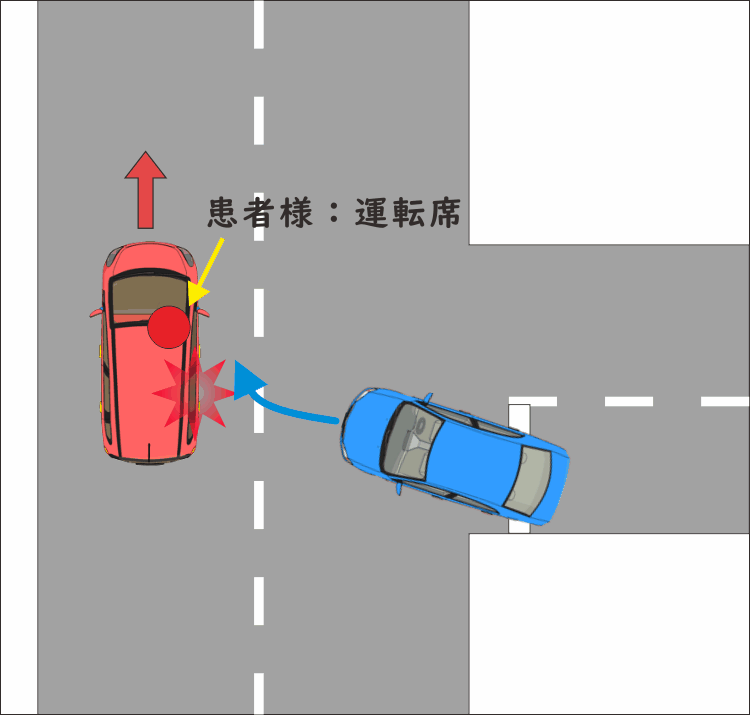 交通事故23 優先道路を直進中 脇道から出てきた車に右側方から追突された交通事故 みどり堂整骨院